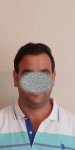 الشهر السابع - زراعة الشعر في تركيا للرجال.jpg