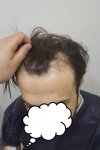 محمد قوتشلو- يوم الزراعة مرحلة التخطيط.jpg