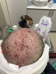 بعد الزراعة فورا (2).jpg